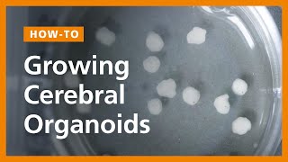 How to Grow Cerebral Organoids from Human Pluripotent Stem Cells [upl. by Iadam669]