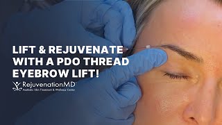 Get a NonSurgical Brow Lift with PDO Threads [upl. by Manheim]