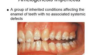 Oral Manifestations of Genetic Abnormalities  Oral Pathology Lecture Ch 6 Pt 2 [upl. by Nanfa650]