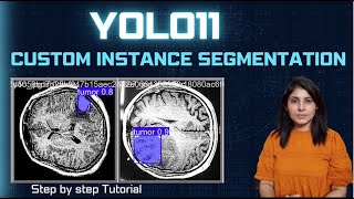 YOLO11 Instance Segmentation on Custom dataset [upl. by Reffinnej]