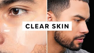 How To Get Clear Skin Only 3 Steps [upl. by Marcy]