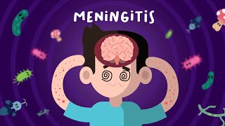 Meningitis  Apakah Berbahaya [upl. by Kimmie]