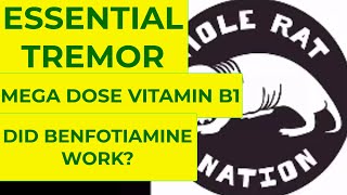 Essential Tremor cure using mega dose vitamin B1 Thiamine using Benfotiamine 3 mon Trial results [upl. by Elak]