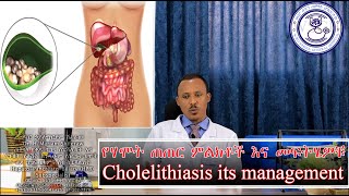 የሃሞት ጠጠር ምልክቶች እና መፍትሄዎቹ Cholelithiasis amp its management [upl. by Pussej]