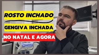 ROSTO INCHADO GENGIVA INCHADA E DENTE DOENDO  E agora [upl. by Abana734]