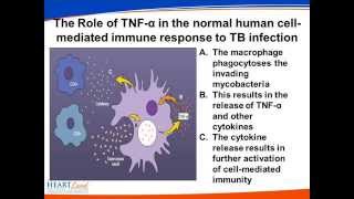 Management of Tuberculosis in Patients on TNF alpha Inhibitors [upl. by Imre196]