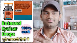 Betnesol N drops use dose benefits and Side effects Full in hindi पुरी जानकारी हिन्दी में [upl. by Dlorad]