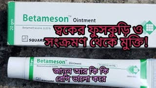 betameson ointment cream  Betameson cream review [upl. by Clovis]