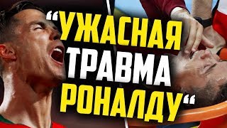 РОНАЛДУ ПРОПУСТИТ ЛИГУ ЧЕМПИОНОВ ИЗЗА УЖАСНОЙ ТРАВМЫ  ВСЕ ПОДРОБНОСТИ [upl. by Hardwick538]