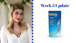 Differin Gel Retinoid Treatment  Week 5 Update [upl. by Nolie]