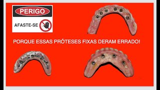 Dentaduras fixas QUE DERAM ERRADO CUIDADO [upl. by Eitsirk]