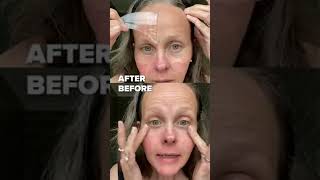 Anti Wrinkle Face Patches to Reduce Fine Wrinkles Reusable [upl. by Novah122]