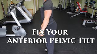 The BEST Way To FIX An Anterior Pelvic Tilt  W Lumbar Hyperlordosis [upl. by Burroughs953]