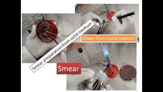 Smear preparation from solid and liquid media Theory and practical based [upl. by Aramen490]