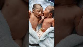 Cutest Twin Newborn Babies Adorable moments AfterBirth [upl. by Schargel]