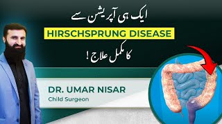 Hirschsprungs Disease Single Surgery Treatment Unveiled by Dr Umar Nisar [upl. by Rawna88]