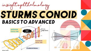 STURMS CONOID  APPLICATIONS AND CONCEPT  Types of astigmatism through sturms conoid [upl. by Leirraj]