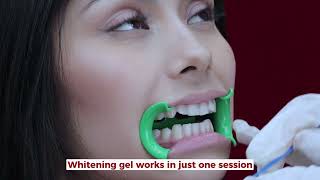 How do we do our teeth whitening [upl. by Howie]