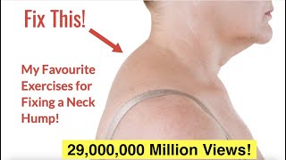 How to Fix a Neck Hump at Home FAST  With FREE Exercise Sheet [upl. by Nylsirhc]