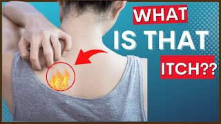 Notalgia Paresthetica “Itchy Back” amp Causes Symptoms amp Tips For Treatment [upl. by Ilyk269]