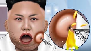 ASMR Facial care for Kim JongUn  Skincare Animation  Removal Ingrown Hair Sebum Shaving [upl. by Derrick999]