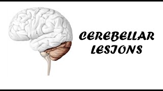 Cerebellar Lesions  Clinical Examination for Cerebellar Examination [upl. by Laehctim975]