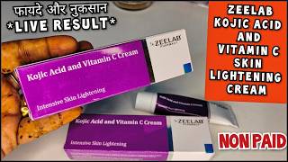 Zeelab Kojic Acid Vitamin C Cream  Kojic acid and vitamin c cream  Honest Review sale review [upl. by Cirala]