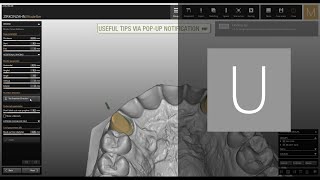 Workflow example from archive to nesting 2015 Modellier version  ZirkonzahnSoftware [upl. by Orofselet]