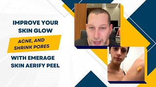 IMPROVE YOUR SKIN GLOW ACNE AND SHRINK PORES WITH EMERAGE SKIN AERIFY PEEL  DR JASON EMER [upl. by Htomit]