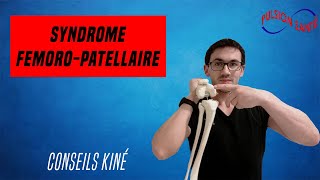 Soigner efficacement le syndrome fémoro patellaire  Conseil KINE et autoexercices [upl. by Amado]