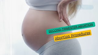 Surgical Abortion Second Trimester  Conditions amp Treatments [upl. by Ihsar]