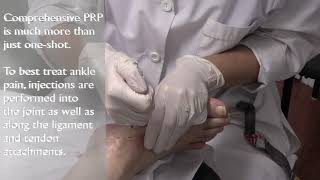 PRP Prolotherapy treatment for chronic ankle pain [upl. by Aniret911]