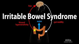 Irritable Bowel Syndrome Pathophysiology Symptoms Causes Diagnosis and Treatment Animation [upl. by Leahcimnoj]