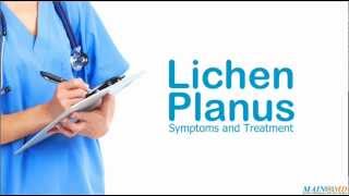 Lichen Planus Symptoms and Treatment [upl. by Nohtanhoj410]