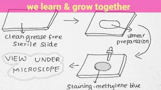 SIMPLE STAINING IN TAMIL microbiology in Tamil [upl. by Kenwrick649]