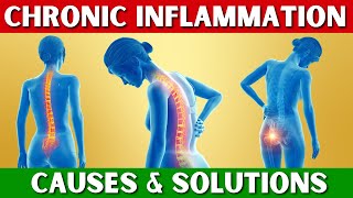 Want Chronic Inflammation RELIEF Watch This Now [upl. by Unhsiv983]