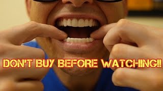 Can you eat with Shiny Smiles Veneers  What you need to know [upl. by Yerbua943]