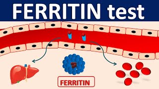 Serum Ferritin test  Its role in inflammation [upl. by Bonn]