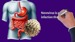 Norovirus 101 What You Need to Know About This Contagious Virus [upl. by Shayne]