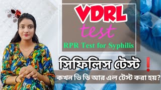 VDRL Test in Bengali  ভি ডি আর এল টেস্ট  সিফিলিস টেস্ট । VDRL Test  Syphilis Test procedure [upl. by Sinylg]