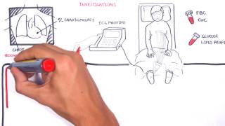 Acute Coronary Syndrome DETAILED Overview MI STEMI NSTEMI [upl. by Assenab]