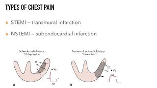 Chest Pain Rapid Review [upl. by Cohligan]