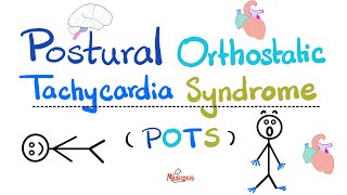 Postural Orthostatic Tachycardia Syndrome POTS  Causes Symptoms Diagnosis TreatmentCardiology [upl. by Oika721]