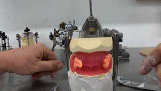 Complete Denture Course Articulating Models after Occlusal Registration [upl. by Starkey57]