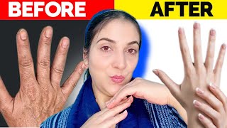 Hand Transformation  Best Remedy For Hand Wrinkles And Sagging Young Beautiful Hands 🙌 [upl. by Anelehs]