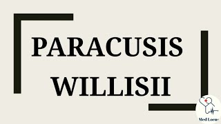 Paracusis Willisii [upl. by Saerdna]