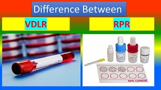 Difference between venereal disease research laboratory VDRL and Rapid Plasma Reagin RPR [upl. by Thorley]