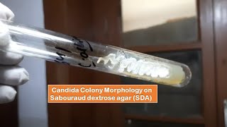 Candida albicans growth on Sabouraud dextrose agar Demonstration [upl. by Nirtak526]