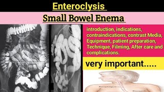 Small Bowel Enema  Enteroclysis  small bowel enema procedure  Barium Enema enteroclysis 2024 [upl. by Tram]