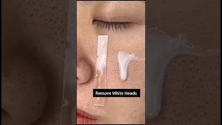 Open Pores Treatment Naturally At Home 😱  Get Rid Open Pores  Whiteheads skincare shorts viral [upl. by Sebastian]